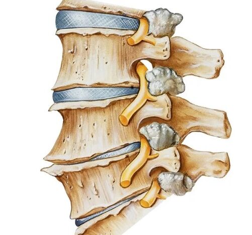 Growing nerve in spine