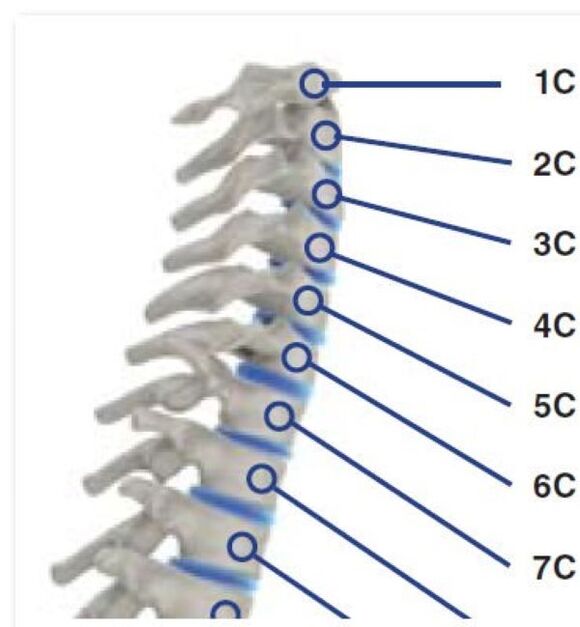 Rook syndrome