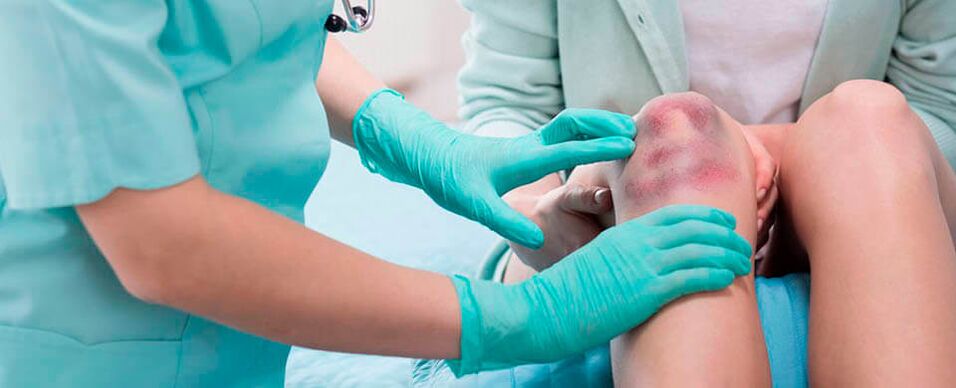 the doctor examines the knee injury