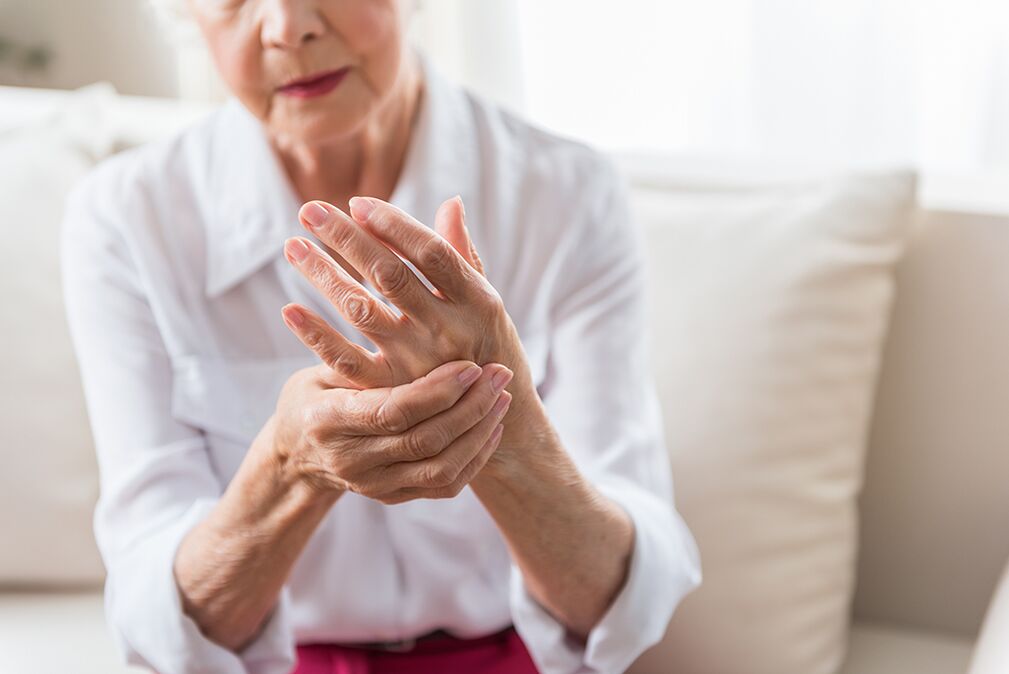 How Arthritis Manifested